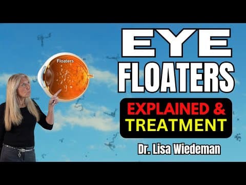 YouTube thumbnail for Eye Floaters - everything you wanted to know