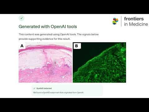 YouTube thumbnail for ChatGPT's Hidden Watermark Exposes AI Generated Case Report (research fraud)