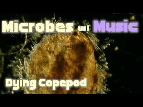 YouTube thumbnail for Copepod Dies