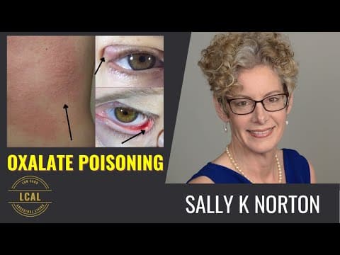 YouTube thumbnail for Oxalate Poisoning & Dumping: What It Looks Like, the Microbiome Myth & Why Zero Carb May Not Work