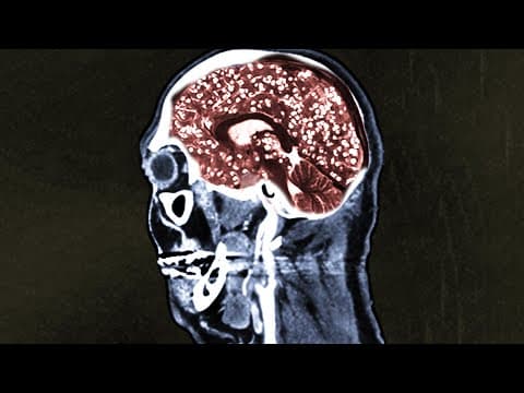 YouTube thumbnail for ChubbyEmu - A Man Ate Pork Tacos From An Illegal Food Truck. This Is What Happened To His Brain (Youtube, 16:31)